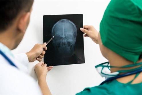 doctor and nurse looking at skull xray